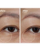 The Ordinary Lacto-PDRN* 4% + B9 Eye Cream cremă pentru ochi impotriva ridurilor din zona ochilor 15 ml