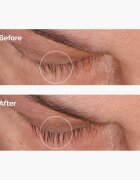 The Ordinary Multi-Peptide Lash and Brow Serum ser pentru gene și sprâncene 5 ml