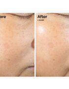 The Ordinary Rice Lipids + Ectoin Microemulsion emulsie hidratantă lejeră pentru netezirea pielii 120 ml