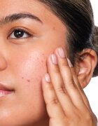 The Ordinary Salicylic Acid 2% Solution ser cu acid salicilic 30 ml