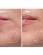 The Ordinary Sulfur 10% Powder-to-Cream Concentrate tratament topic pentru acnee 5 g
