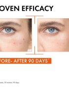 Vichy Liftactiv Supreme ser facial cu efect iluminator cu vitamina C 20 ml