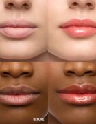 WONDERSKIN Lip Rehab Serum Oil ulei pentru buze culoare 3.57 ml
