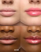 WONDERSKIN Lip Rehab Serum Oil ulei pentru buze culoare amour 3.57 ml