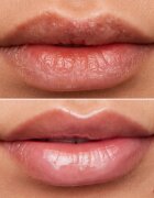 WONDERSKIN Lip Rehab Therapy Oil ulei pentru buze cu efect de hidratare culoare Clear 357 ml