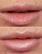 WONDERSKIN Lip Rehab Therapy Oil ulei pentru buze cu efect de hidratare culoare Clear 357 ml
