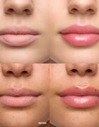 WONDERSKIN Lip Relapse Plumping Gloss lip gloss cu efect de crestere culoare Clear 3.57 ml