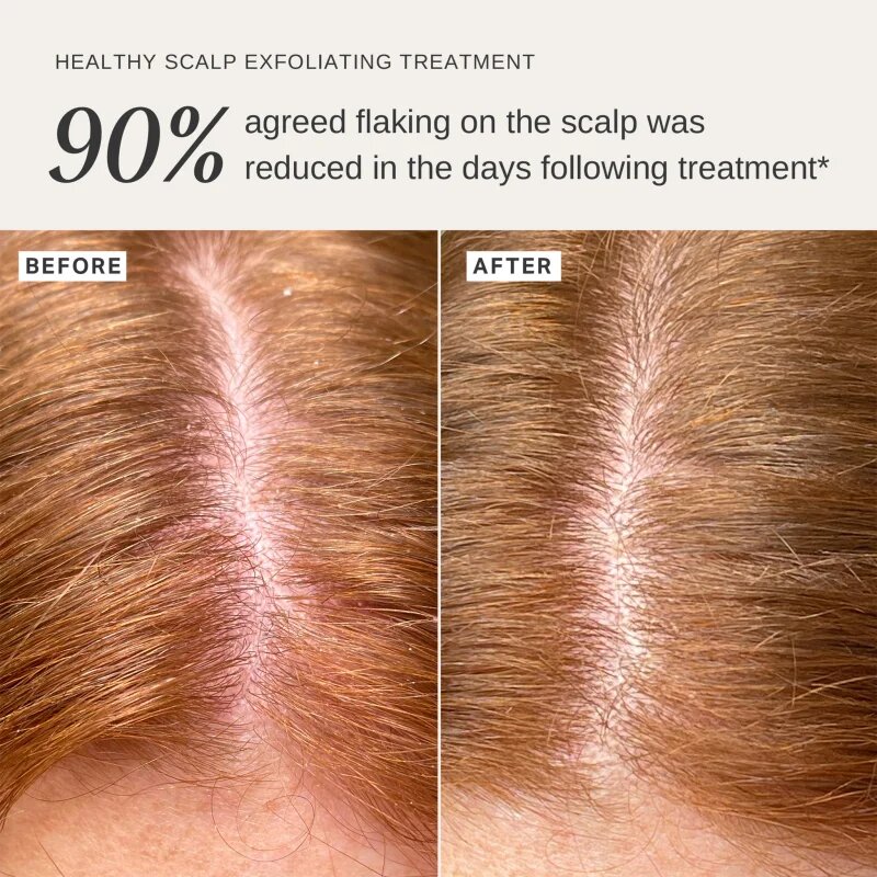 Alpha-H Healthy Scalp soluție exfoliantă pentru cap 100 ml