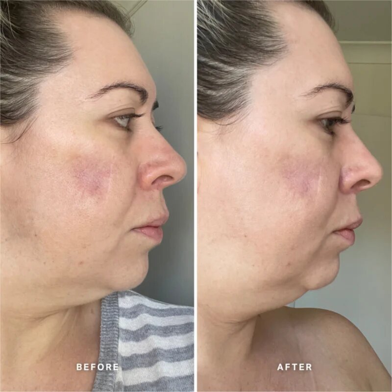 Alpha-H Vitamin A ser cu vitamina A 25 ml