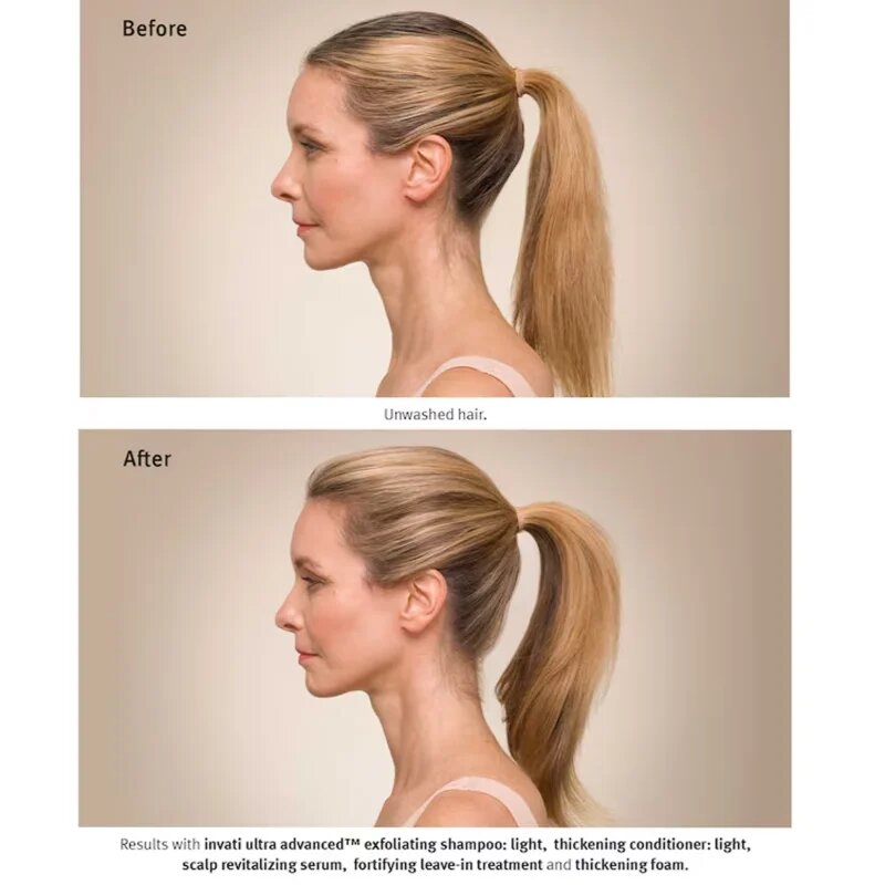 Aveda Invati Ultra Advanced™ Revitalizing Scalp Serum ser revigorant pentru par si scalp 30 ml