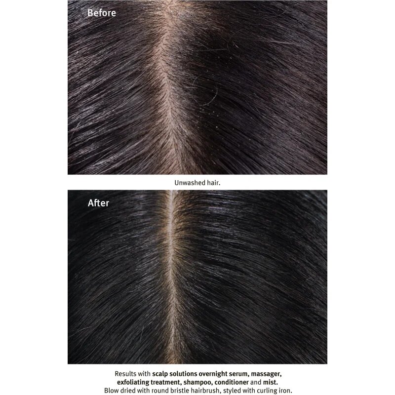 Aveda Scalp Solutions Replenishing Conditioner balsam delicat nutritie si hidratare 200 ml