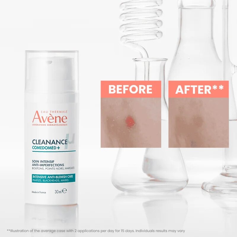 Avène Cleanance Comedomed+ ingrijire intensiva impotriva imperfectiunilor pielii cauzate de acnee 30 ml