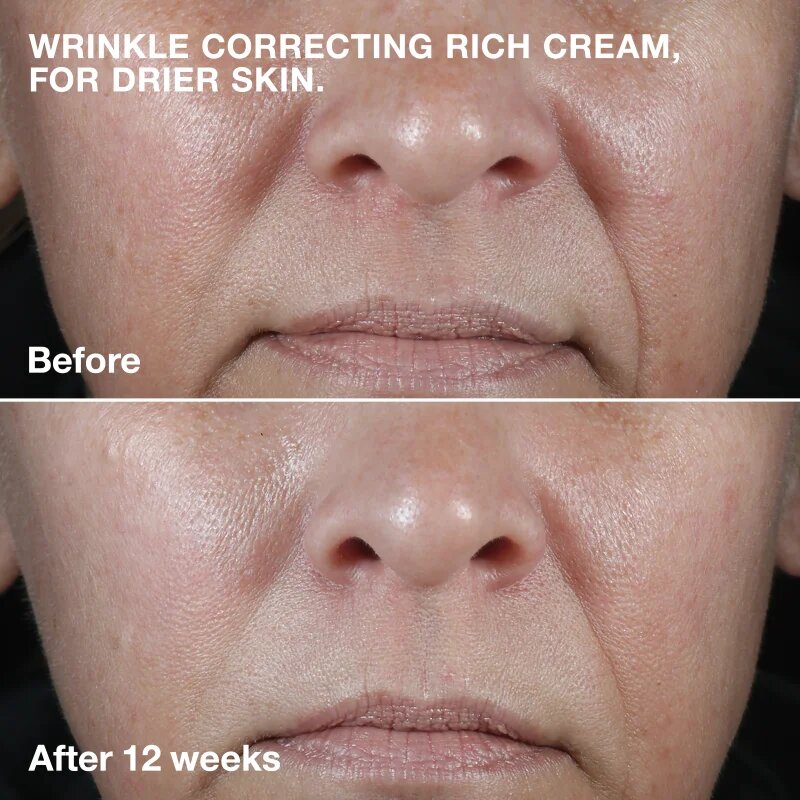 Clinique Smart Clinical™ Repair Wrinkle Correcting Cream cremă nutritivă antirid 50 ml