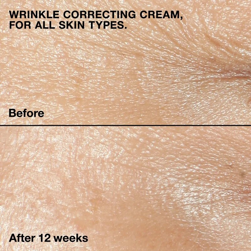 Clinique Smart Clinical™ Repair Wrinkle Correcting Cream cremă nutritivă antirid 50 ml
