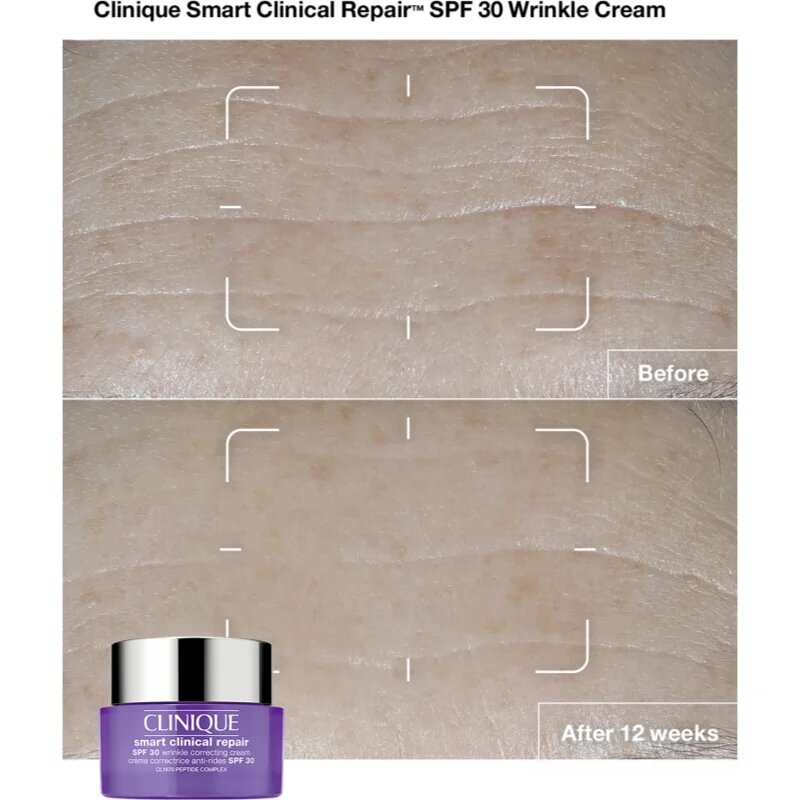 Clinique Smart Clinical™ Repair Wrinkle Correcting Cream SPF 30 crema anti-rid SPF 30 50 ml
