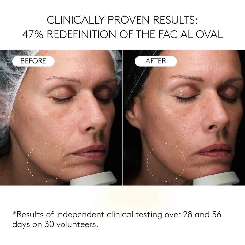 Cocunat Clinical Exosomes ser cu efect de lifting 30 ml