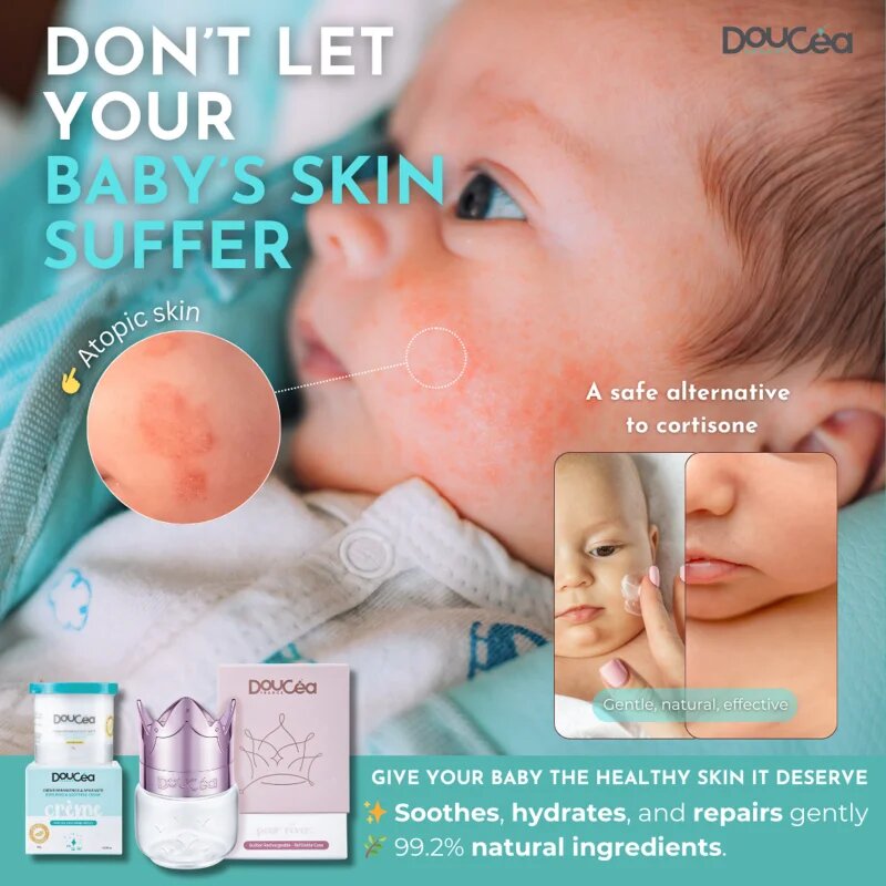 Doucea Doutopia Cream crema de regenerare pentru piele atopica pentru copii si adulti 50 g