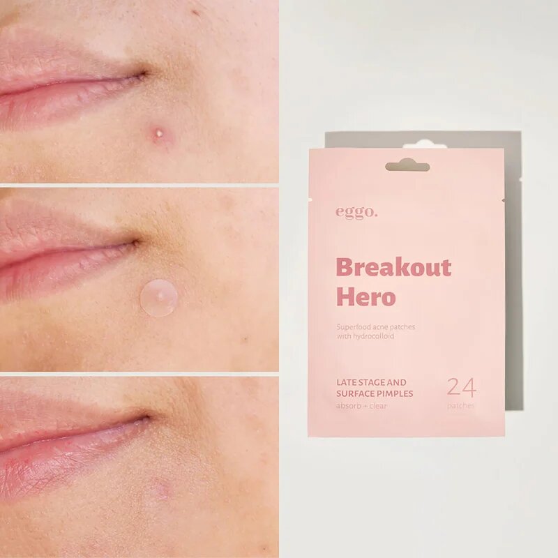 Eggo Breakout Hero plasturi pentru piele problematică 24 buc
