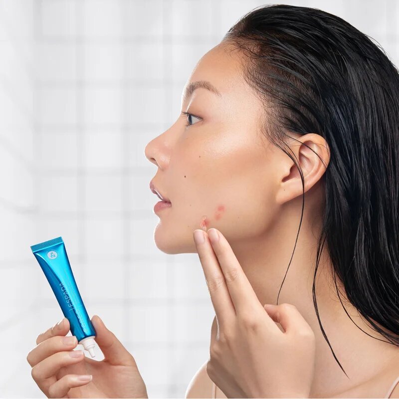 FOREO ESPADA™ BHA+PHA Blemish Solution gel topic pentru acnee 15 ml