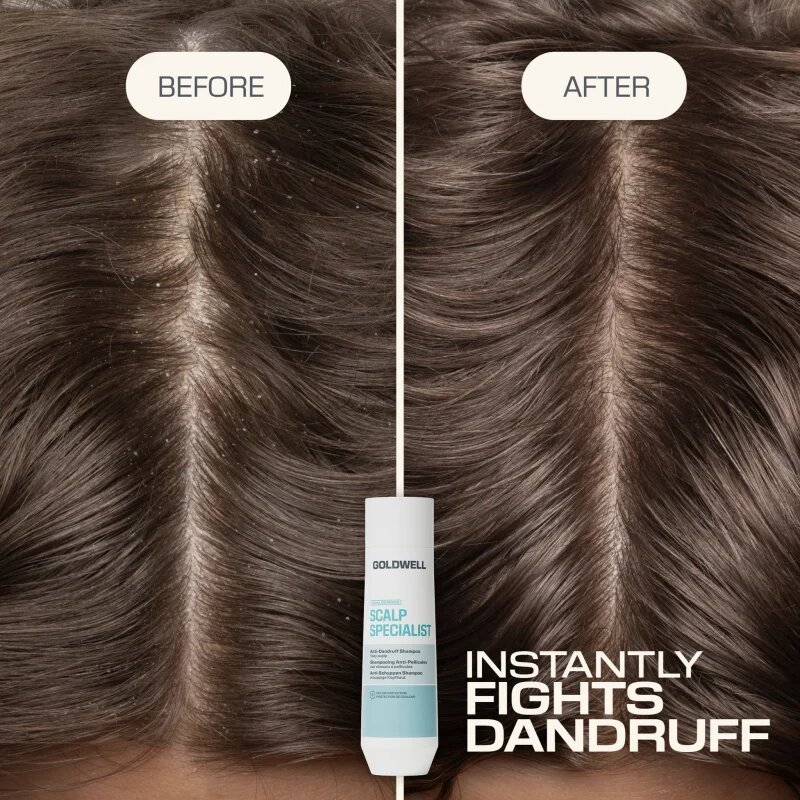Goldwell Dualsenses Scalp Specialist Anti-Dandruff Shampoo sampon anti-matreata 250 ml