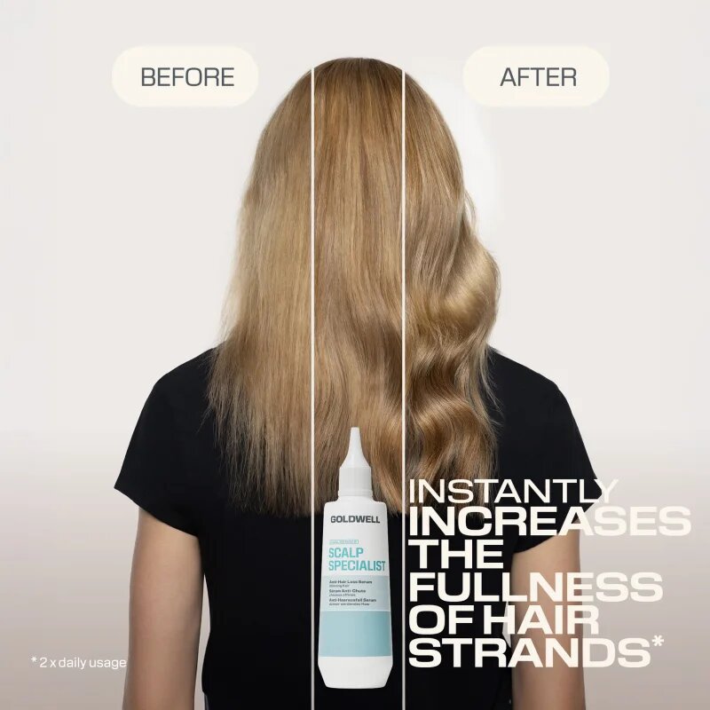 Goldwell Dualsenses Scalp Specialist Anti-Hair Loss Serum ser impotriva caderii parului 150 ml