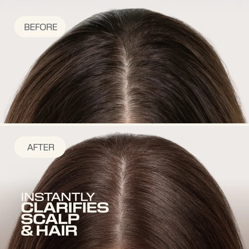 Goldwell Dualsenses Scalp Specialist Clarifying Shampoo curatarea profunda a scalpului 250 ml