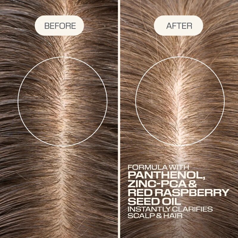 Goldwell Dualsenses Scalp Specialist Clarifying Shampoo curatarea profunda a scalpului 250 ml