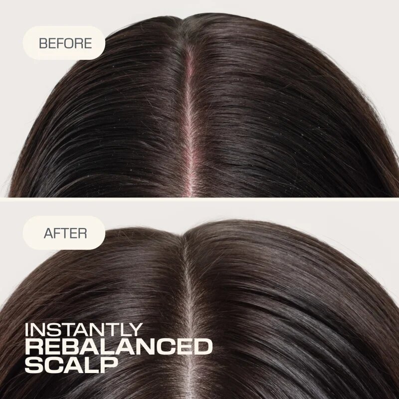 Goldwell Dualsenses Scalp Specialist Rebalance & Hydrate Fluid fluid hidratant pentru refacerea scalpului 150 ml