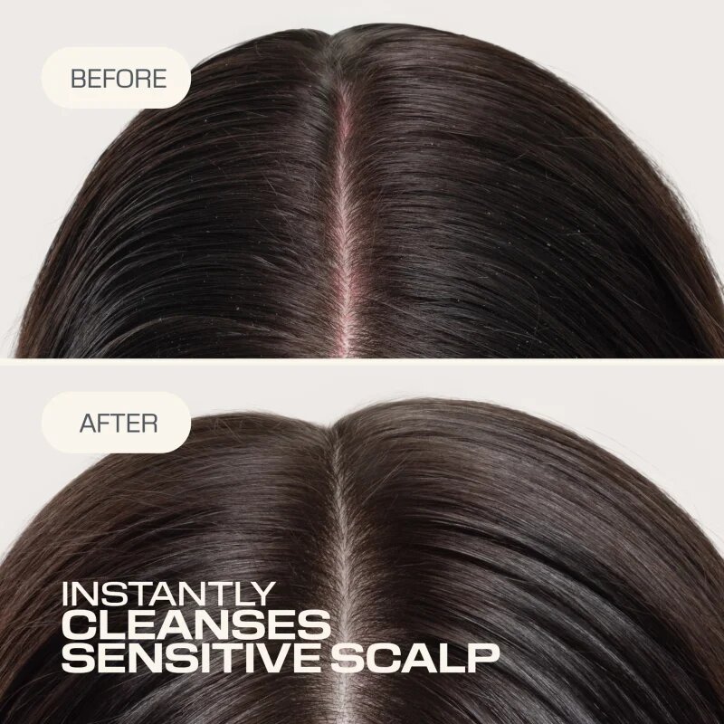 Goldwell Dualsenses Scalp Specialist Sensitive Foam Shampoo sampon spuma pentru piele sensibila 250 ml