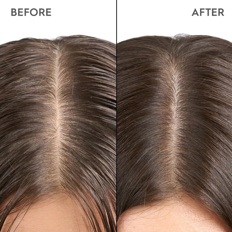 KERASILK Specialists Exfoliating Scalp & Hair Treatment tratament pre-sampon cu efect de exfoliere 200 ml