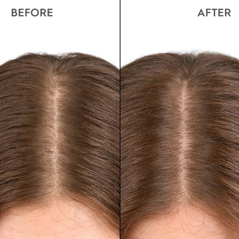 KERASILK Specialists Moisturizing Scalp Drops picături pentru scalp sensibil si uscat 100 ml