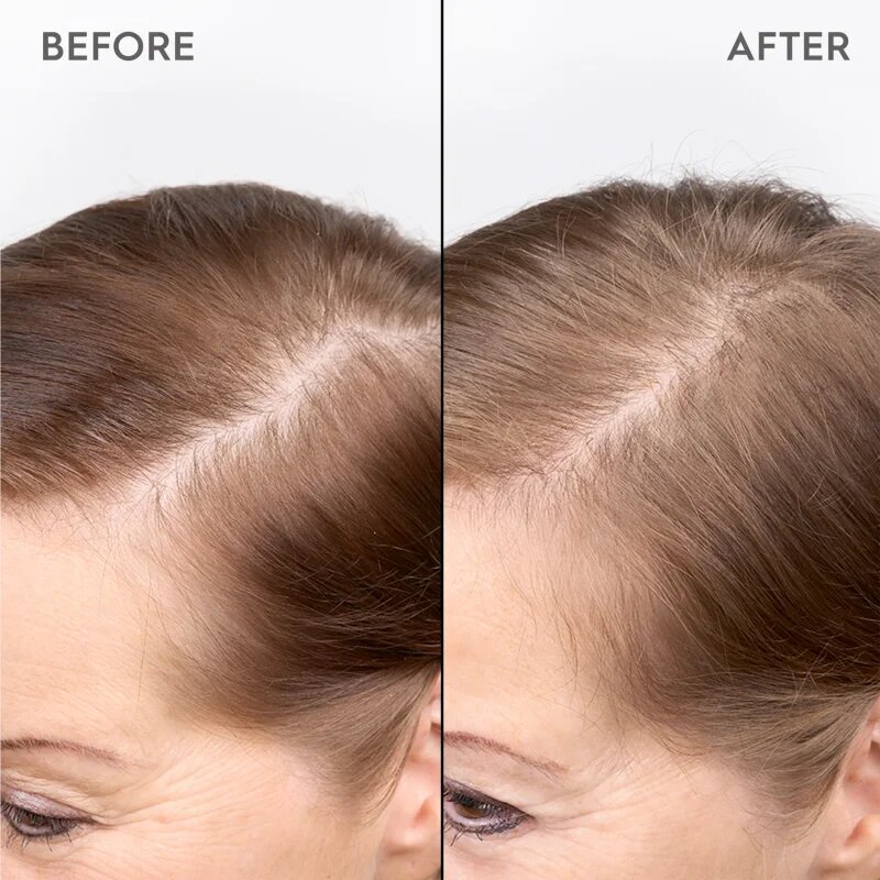 KERASILK Specialists Redensifying Scalp Serum ser de păr pentru a restabili densitatea parului 100 ml