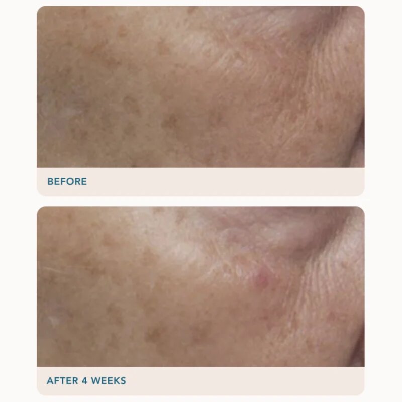 LANCER GRAVITY DARK SPOT CORRECTING SERUM ser impotriva petelor intunecate 30 ml