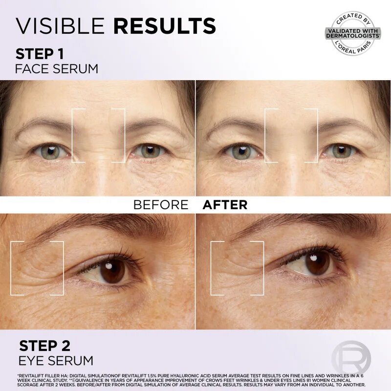L’Oréal Paris Revitalift Filler set pentru îngrijirea pielii pentru fata si zona ochilor
