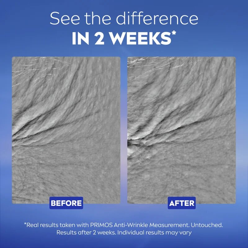 Nivea Cellular Epigenetics Ser de Ochi pentru Întinerire 15 ml