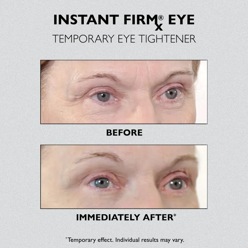 Peter Thomas Roth Instant FIRMx Eye crema de ochi pentru intinerirea pielii 30 ml