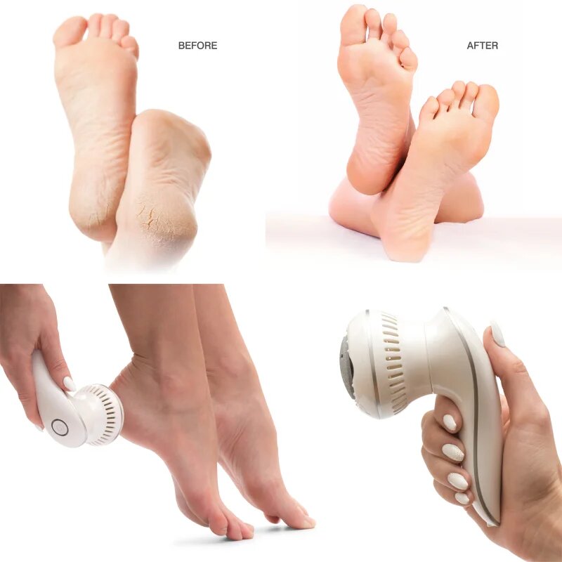RIO 60 Second Spa Pedi 3 pentru îndepărtarea bătăturilor 1 buc