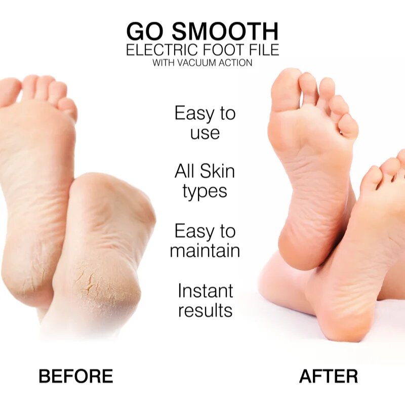RIO Go Smooth Vacuum Action pila electronica pentru calcaie 1 buc
