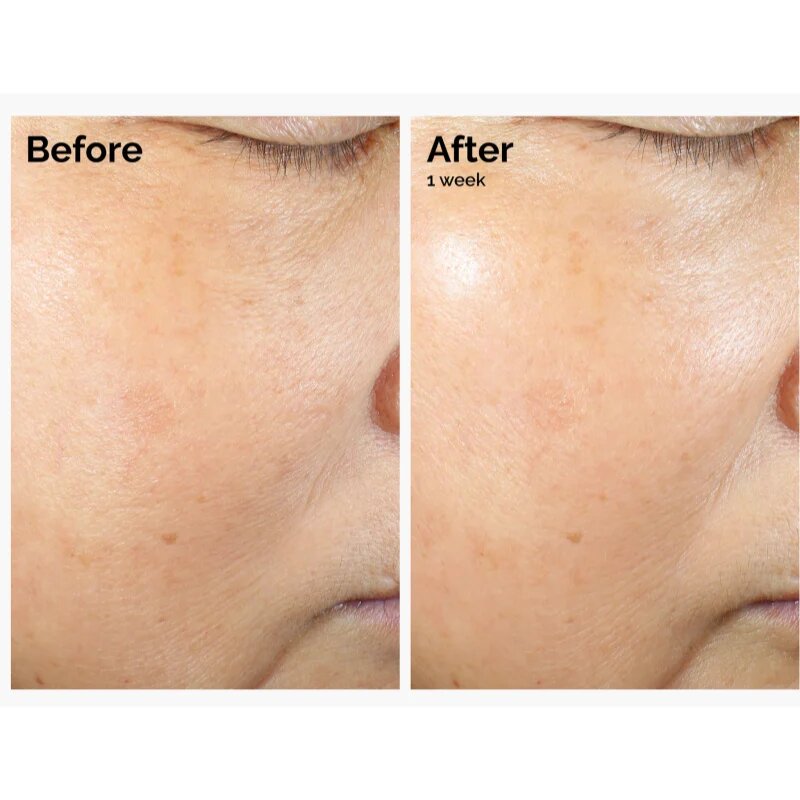 The Ordinary Rice Lipids + Ectoin Microemulsion emulsie hidratantă lejeră pentru netezirea pielii 120 ml