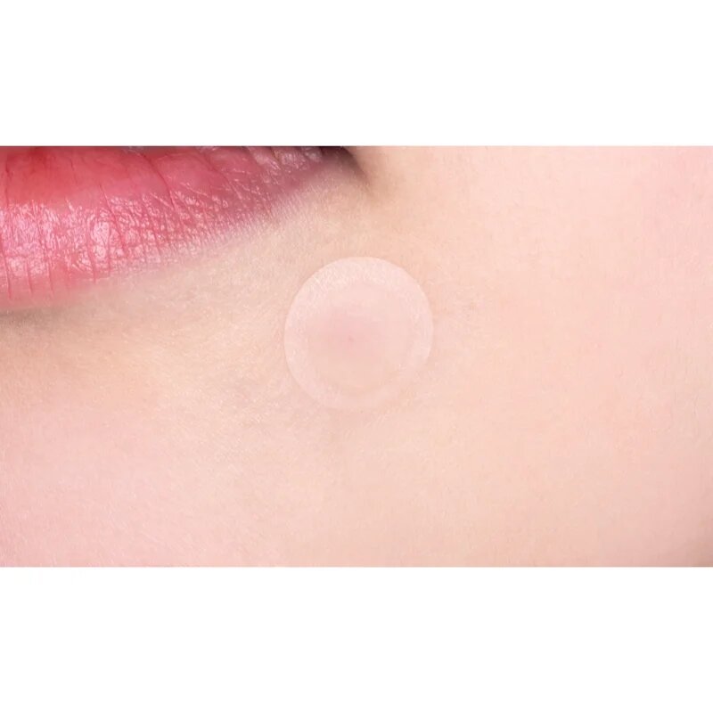 VT Cosmetics Cica Spot Patch plasturi pentru piele problematică 48 buc