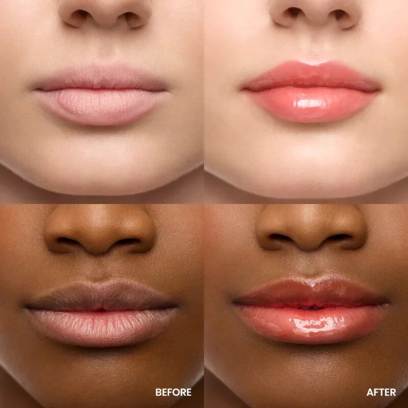 WONDERSKIN Lip Rehab Serum Oil ulei pentru buze culoare 3.57 ml