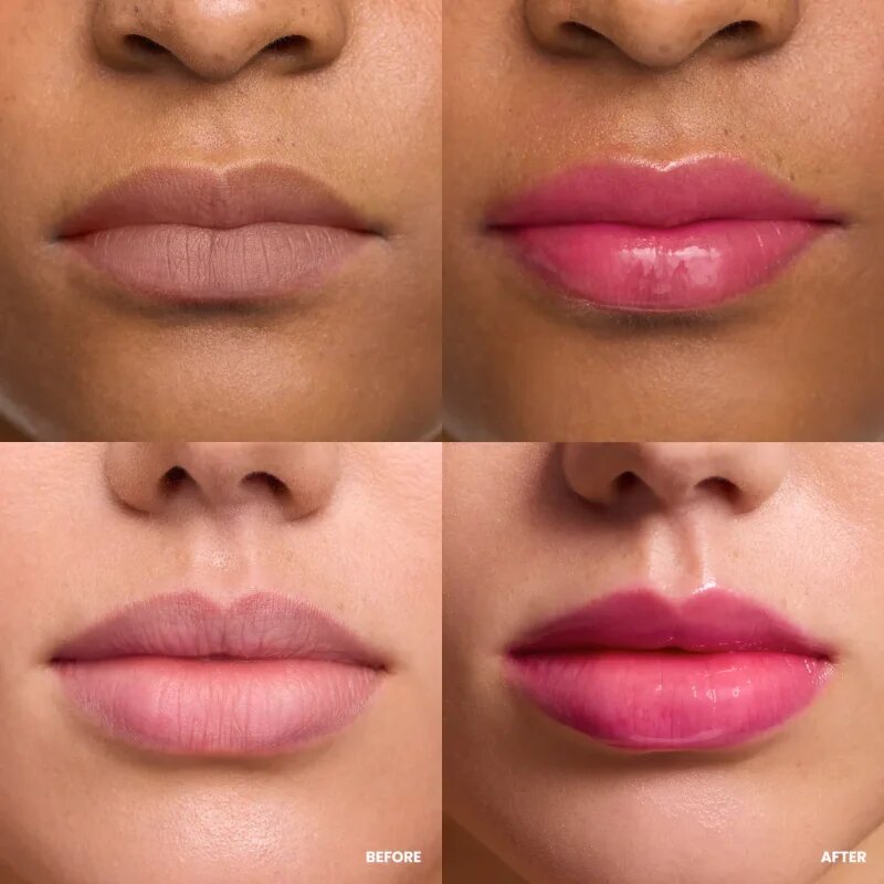 WONDERSKIN Lip Rehab Serum Oil ulei pentru buze culoare Kissed 3.57 ml